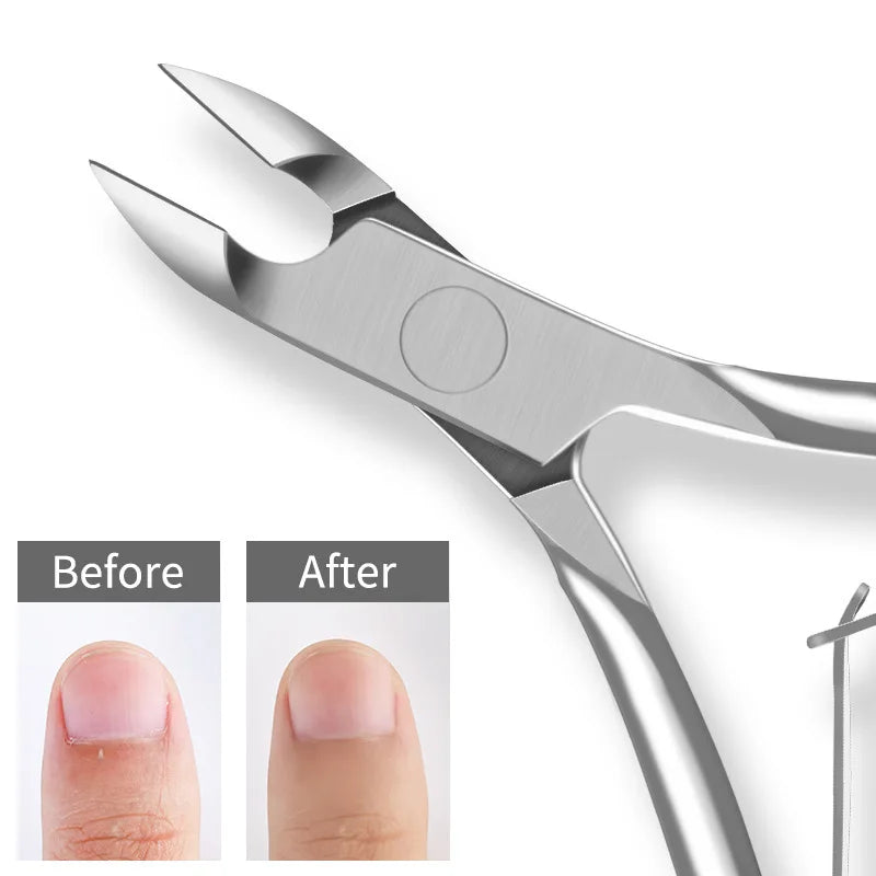 1pc Professional Cuticle Cutter Nail Nippers Scissors Manicure Pusher Pedicure Tong Dead Skin Remover Nail Cuticle Regrowth Tool